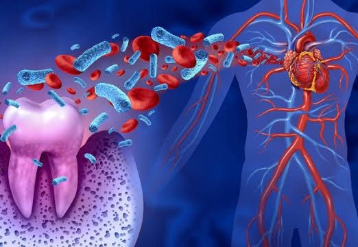 Profissional explica qual a ligação de infecções dentárias com doenças cardíacas