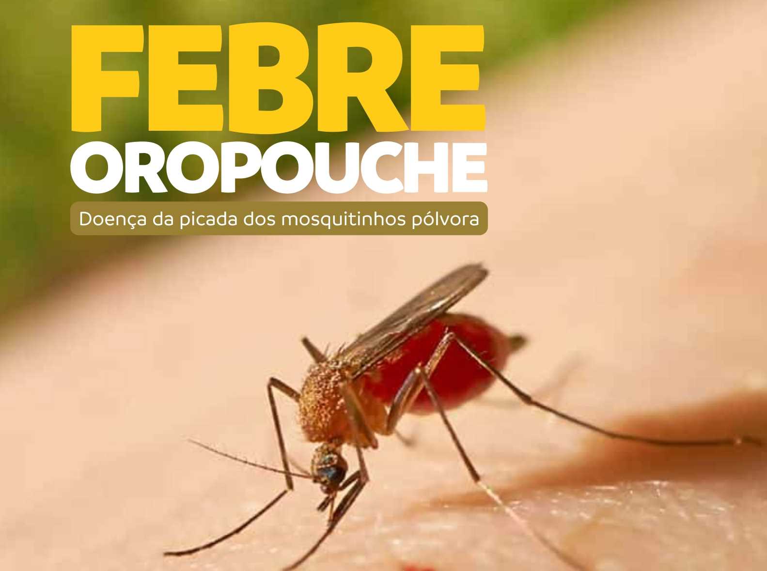 Febre Oropouche: conheça os sintomas e como se prevenir