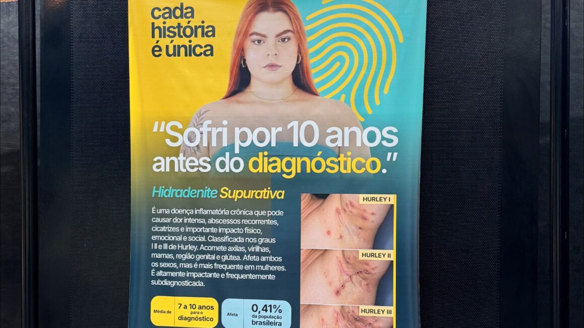 Tour Nacional pelas Doenças Crônicas de Pele chega ao Terminal Tietê nesta terça