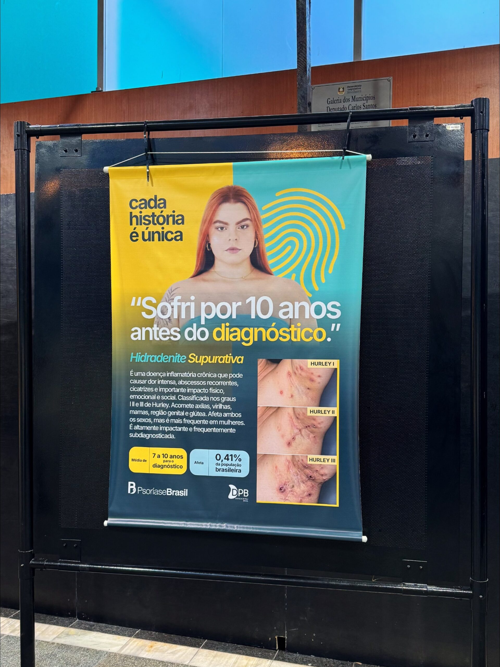 Tour Nacional pelas Doenças Crônicas de Pele no Terminal Rodoviário Tietê, em São Paulo.